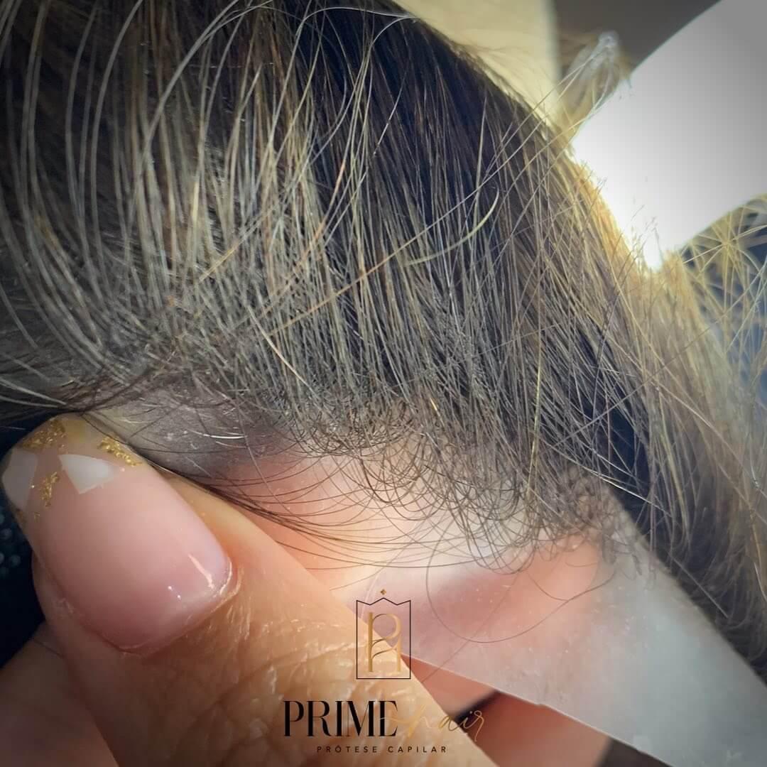 Modelo 320i Micropele - Prime Hair Próteses Capilares